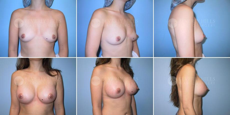 Beverly Hills Plastic Surgery gallery image 230