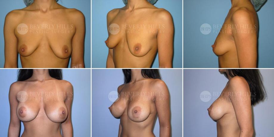 Beverly Hills Plastic Surgery gallery image 241