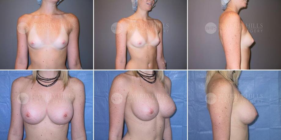 Beverly Hills Plastic Surgery gallery image 242
