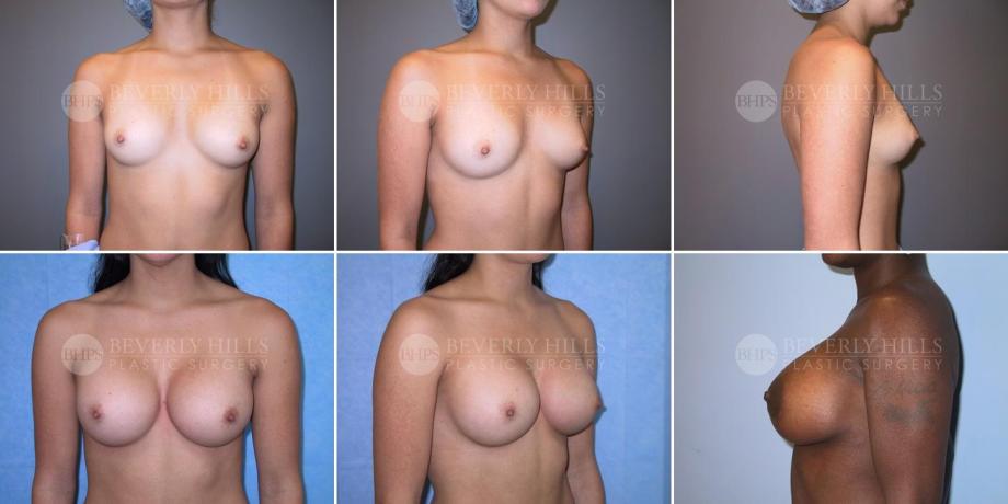 Beverly Hills Plastic Surgery gallery image 247