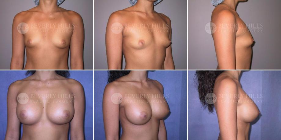 Beverly Hills Plastic Surgery gallery image 249