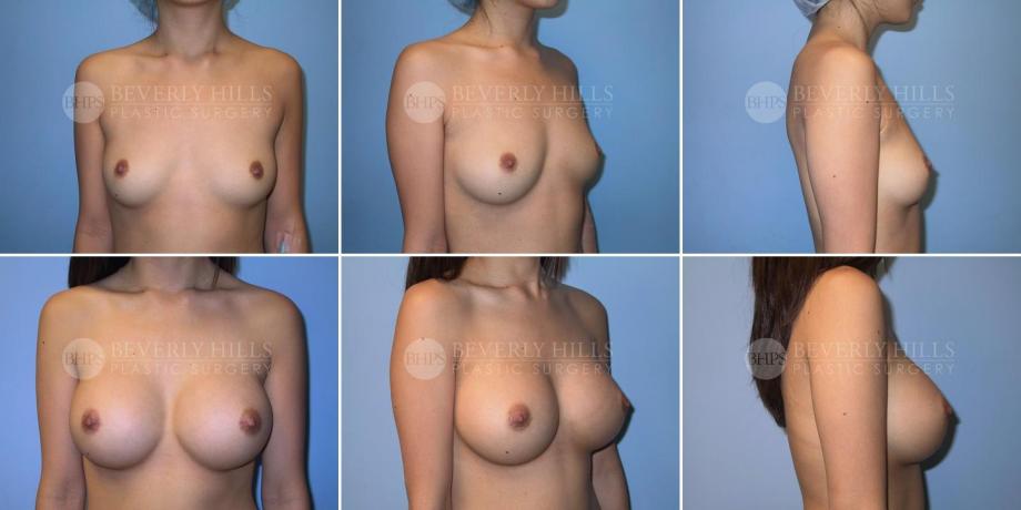 Beverly Hills Plastic Surgery gallery image 250