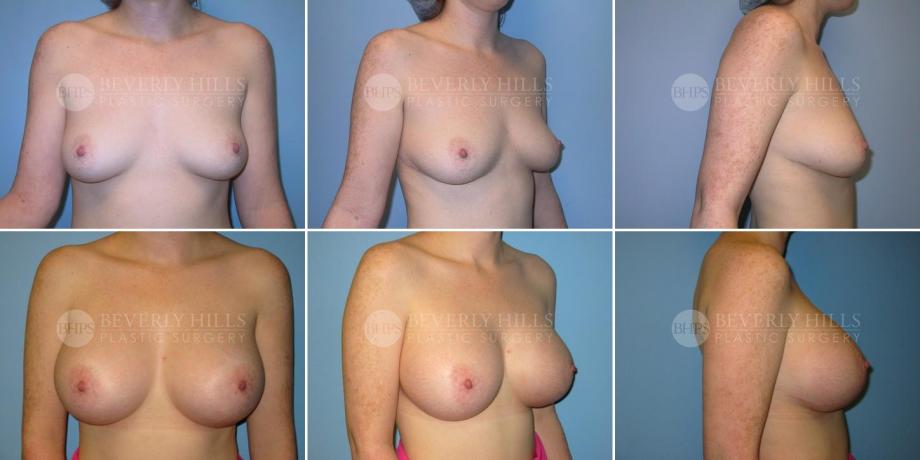 Beverly Hills Plastic Surgery gallery image 255