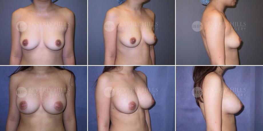 Beverly Hills Plastic Surgery gallery image 261