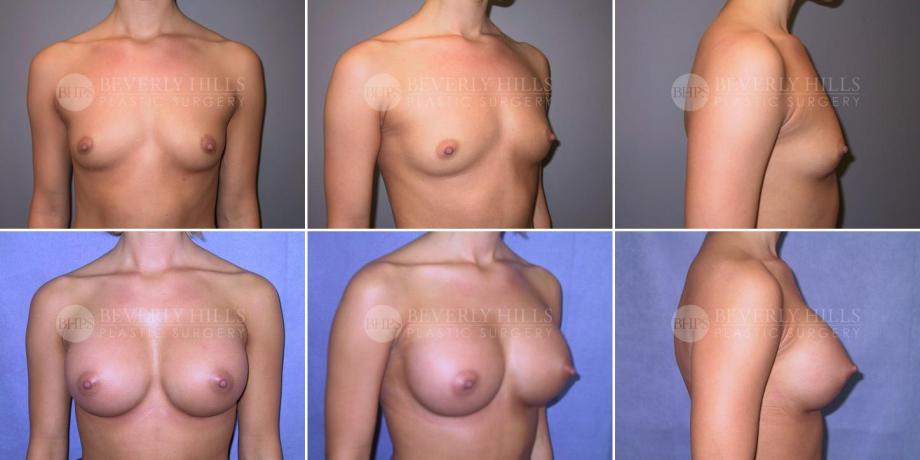 Beverly Hills Plastic Surgery gallery image 262