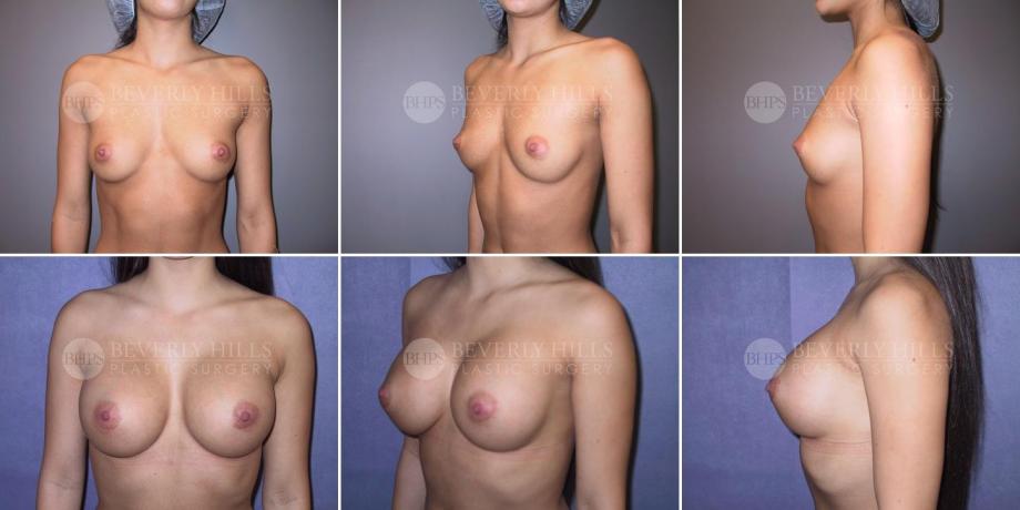 Beverly Hills Plastic Surgery gallery image 270