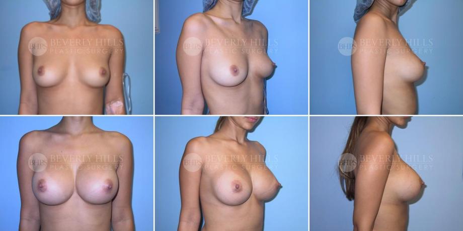 Beverly Hills Plastic Surgery gallery image 273