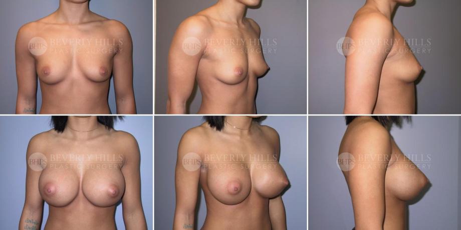 Beverly Hills Plastic Surgery gallery image 275