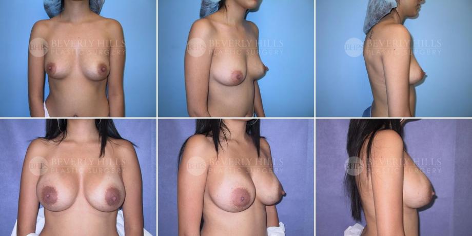 Beverly Hills Plastic Surgery gallery image 276