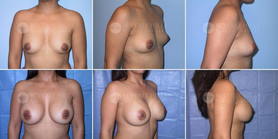Beverly Hills Plastic Surgery gallery image 277