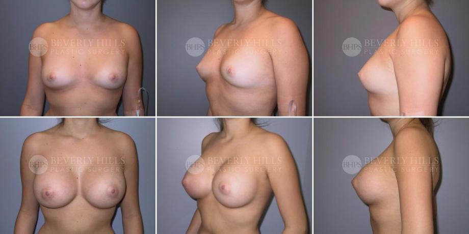 Beverly Hills Plastic Surgery gallery image 280