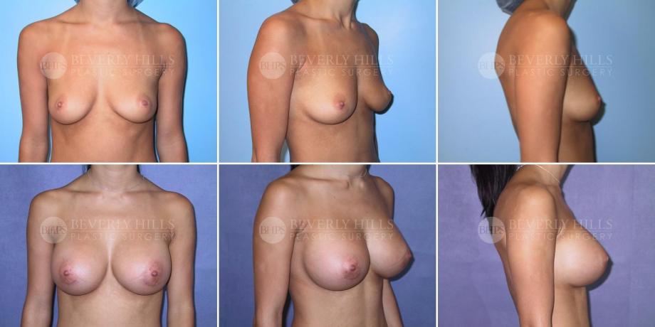 Beverly Hills Plastic Surgery gallery image 281