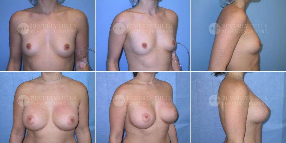 Beverly Hills Plastic Surgery gallery image 283