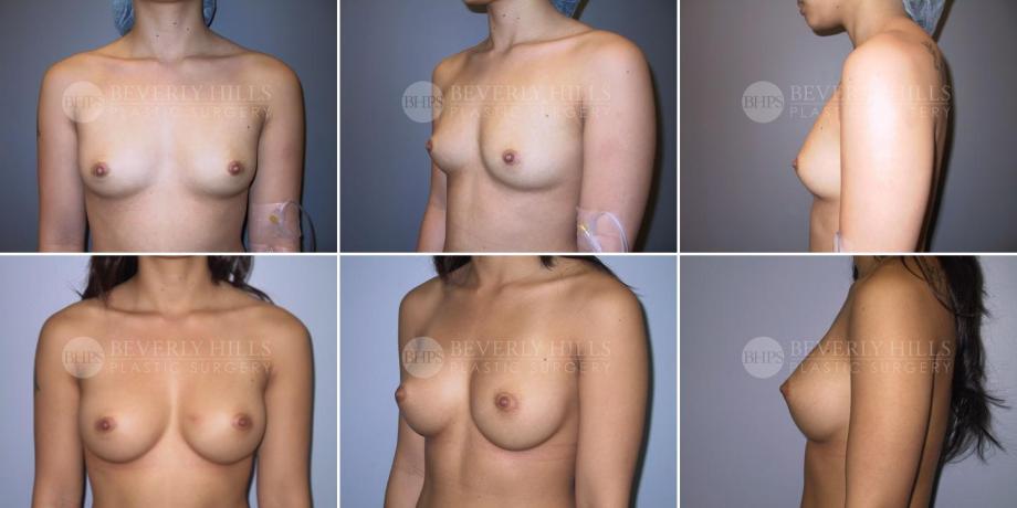 Beverly Hills Plastic Surgery gallery image 290