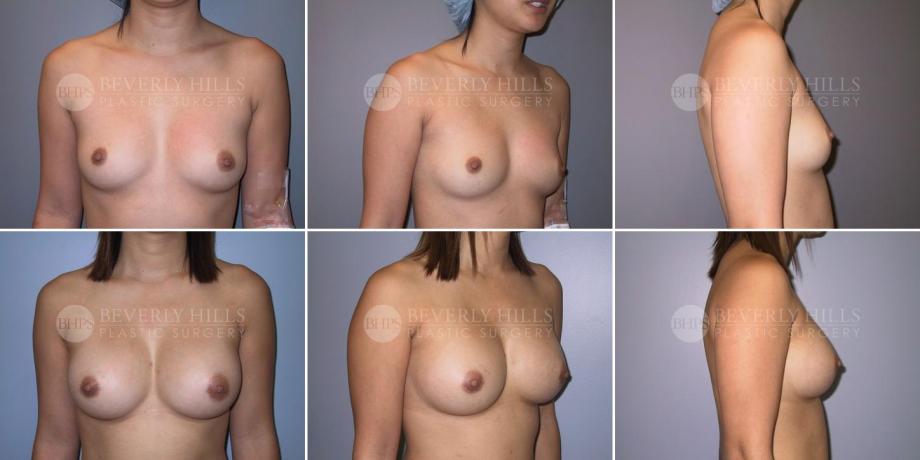 Beverly Hills Plastic Surgery gallery image 291
