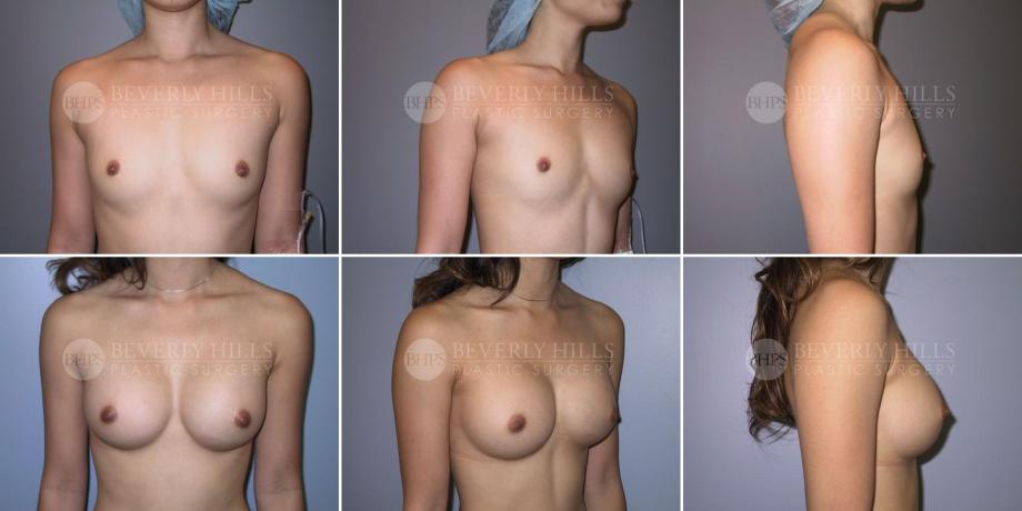 Beverly Hills Plastic Surgery gallery image 295