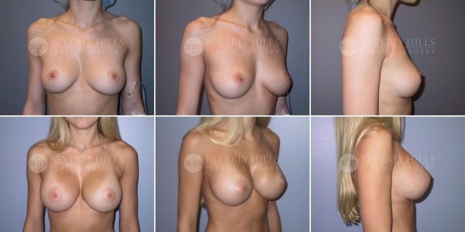 Beverly Hills Plastic Surgery gallery image 297