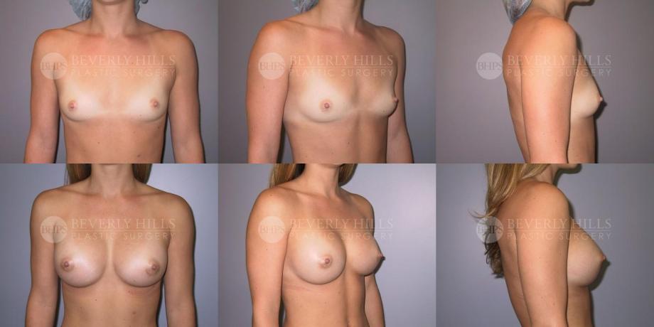 Beverly Hills Plastic Surgery gallery image 300