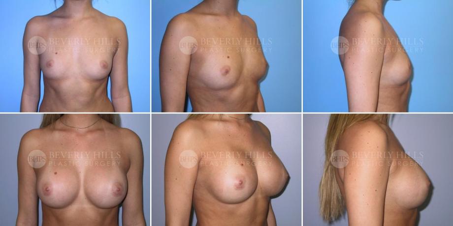 Beverly Hills Plastic Surgery gallery image 302