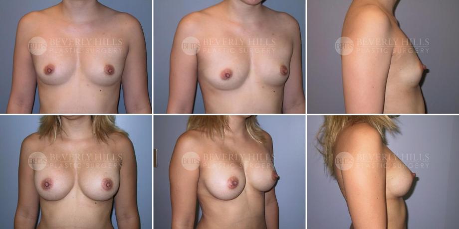 Beverly Hills Plastic Surgery gallery image 307