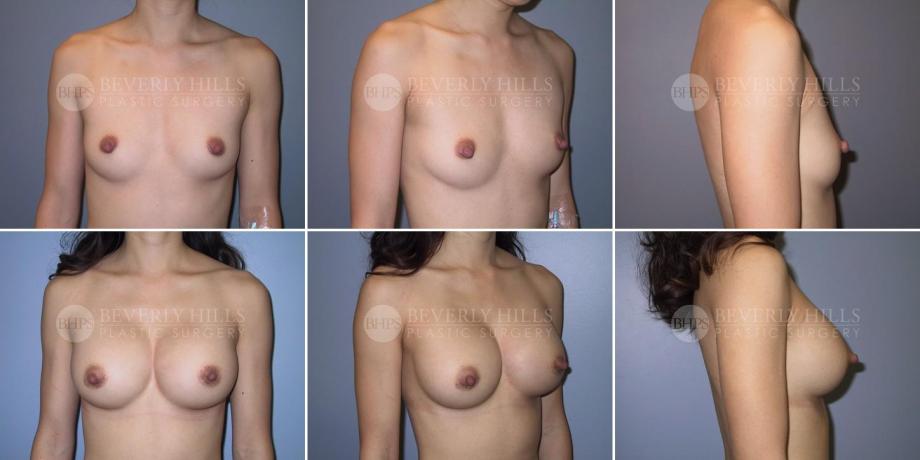 Beverly Hills Plastic Surgery gallery image 309