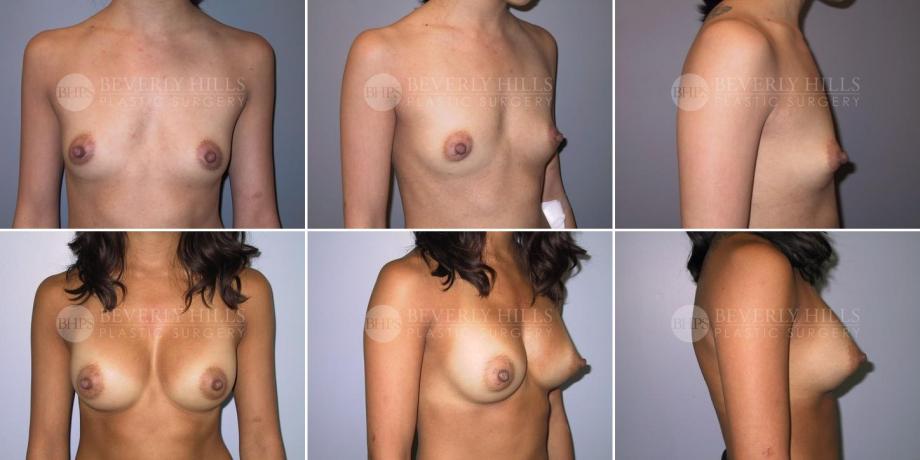 Beverly Hills Plastic Surgery gallery image 310