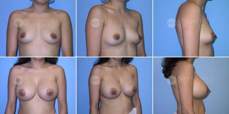 Beverly Hills Plastic Surgery gallery image 312