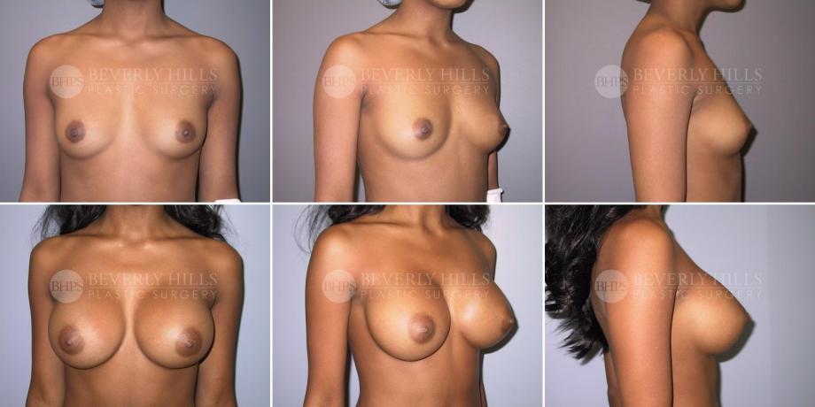 Beverly Hills Plastic Surgery gallery image 315