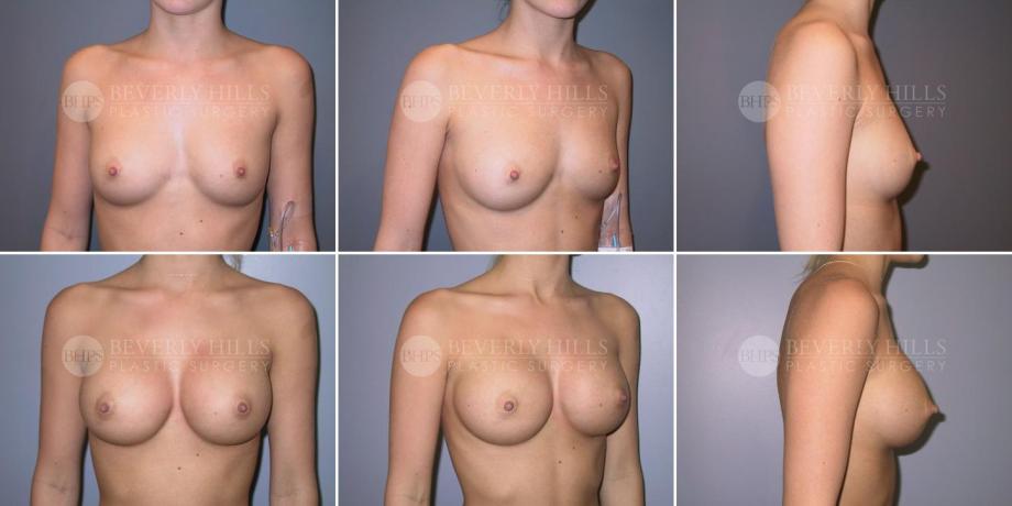 Beverly Hills Plastic Surgery gallery image 316