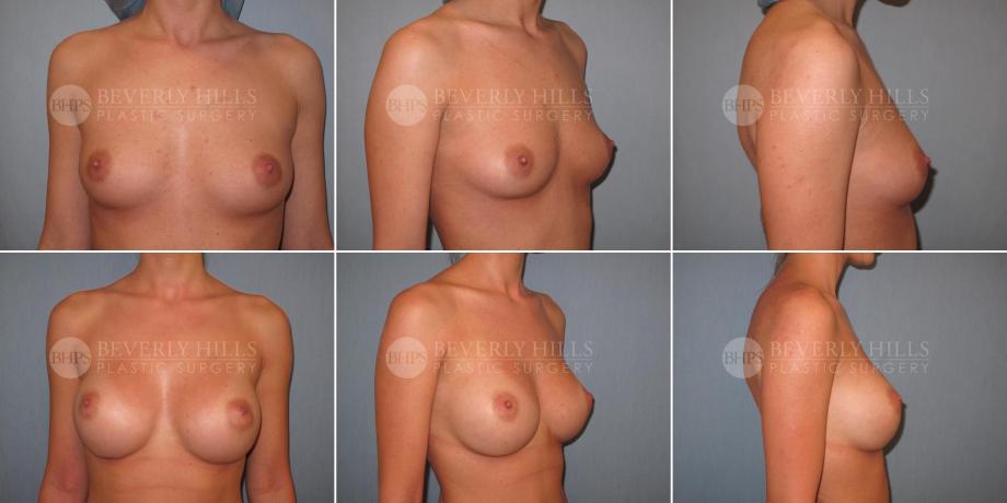 Beverly Hills Plastic Surgery gallery image 325