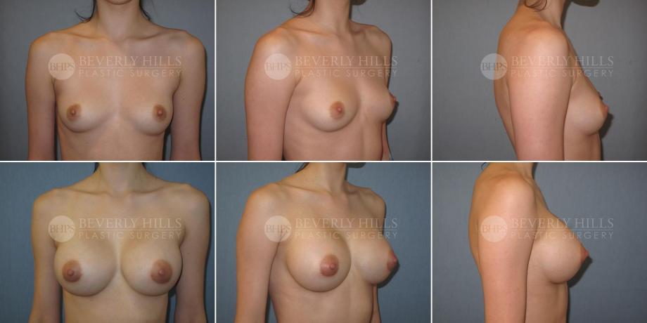 Beverly Hills Plastic Surgery gallery image 327