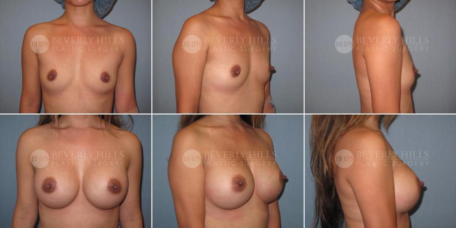 Beverly Hills Plastic Surgery gallery image 331