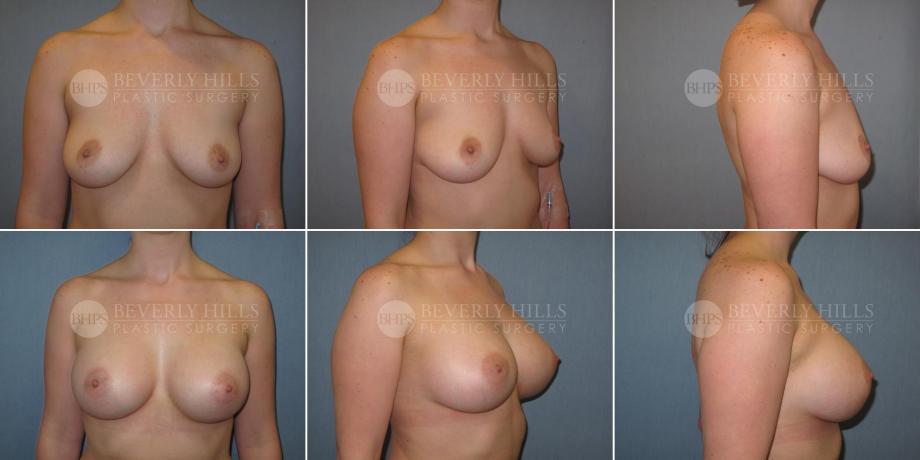 Beverly Hills Plastic Surgery gallery image 333