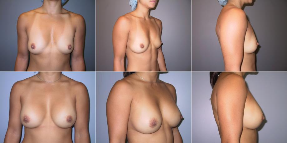 Beverly Hills Plastic Surgery gallery image 341