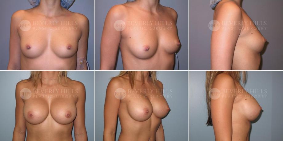 Beverly Hills Plastic Surgery gallery image 349