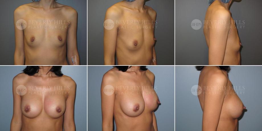 Beverly Hills Plastic Surgery gallery image 356