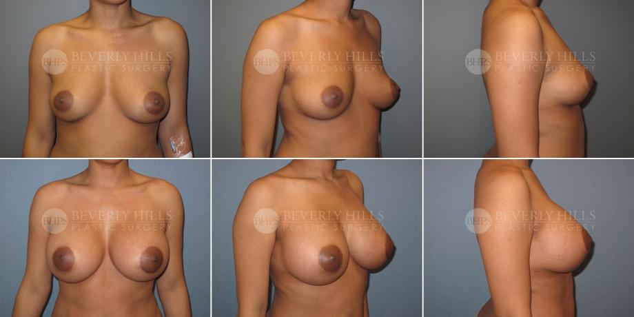 Beverly Hills Plastic Surgery gallery image 357