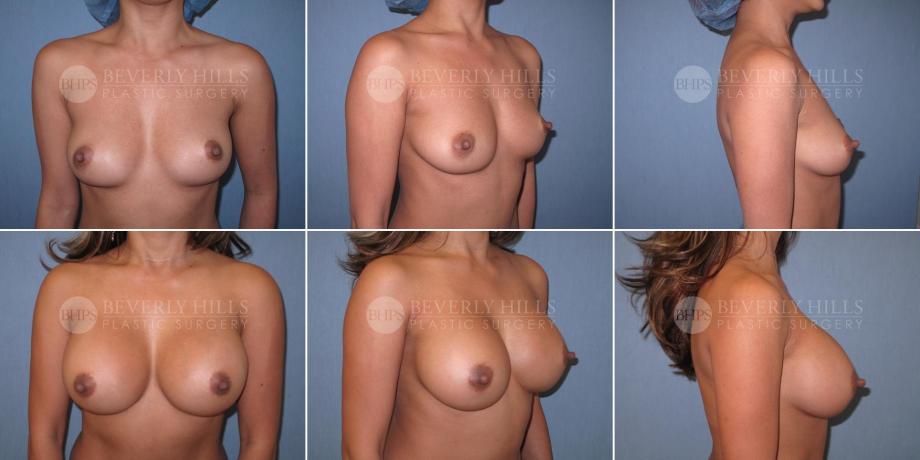 Beverly Hills Plastic Surgery gallery image 359