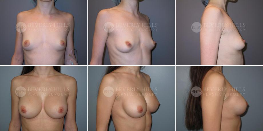 Beverly Hills Plastic Surgery gallery image 360