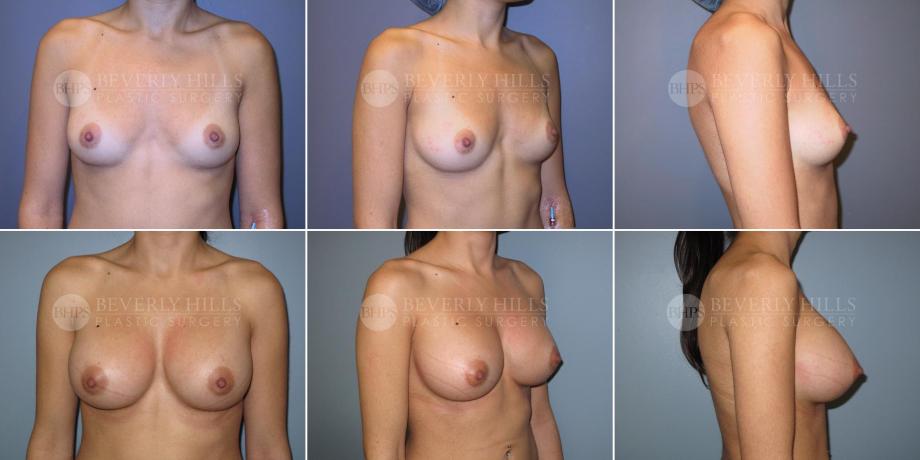 Beverly Hills Plastic Surgery gallery image 361