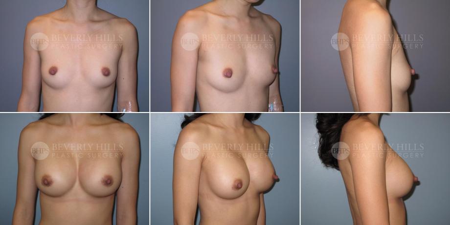 Beverly Hills Plastic Surgery gallery image 362