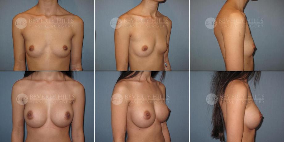 Beverly Hills Plastic Surgery gallery image 365