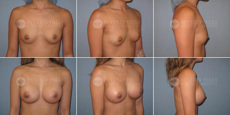 Beverly Hills Plastic Surgery gallery image 367