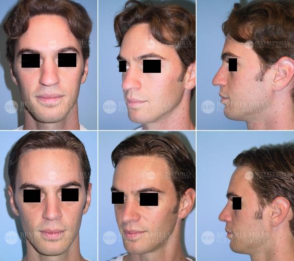 Beverly Hills Plastic Surgery gallery image 370