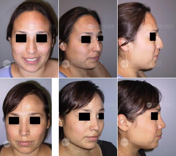 Beverly Hills Plastic Surgery gallery image 373