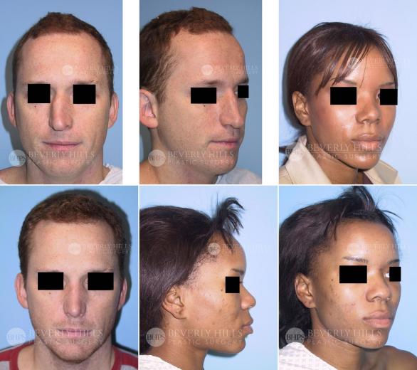 Beverly Hills Plastic Surgery gallery image 377