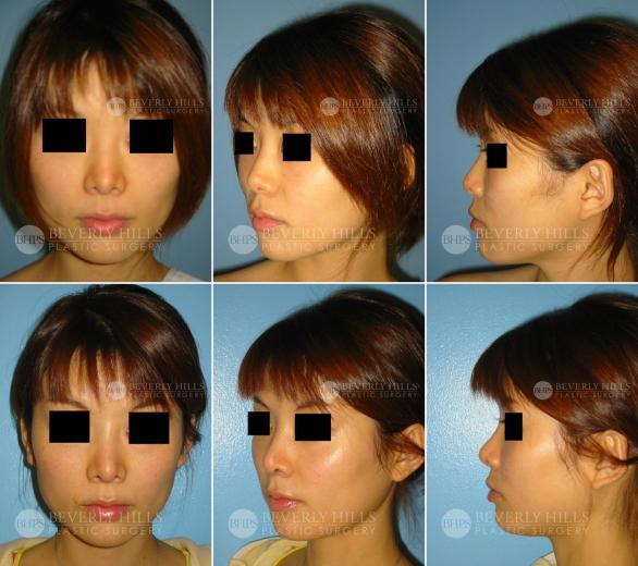 Beverly Hills Plastic Surgery gallery image 380
