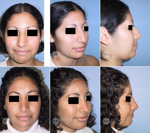 Beverly Hills Plastic Surgery gallery image 381
