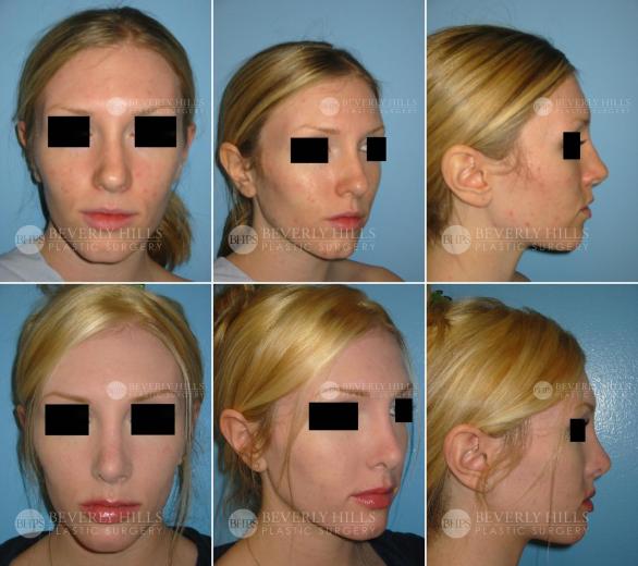 Beverly Hills Plastic Surgery gallery image 382