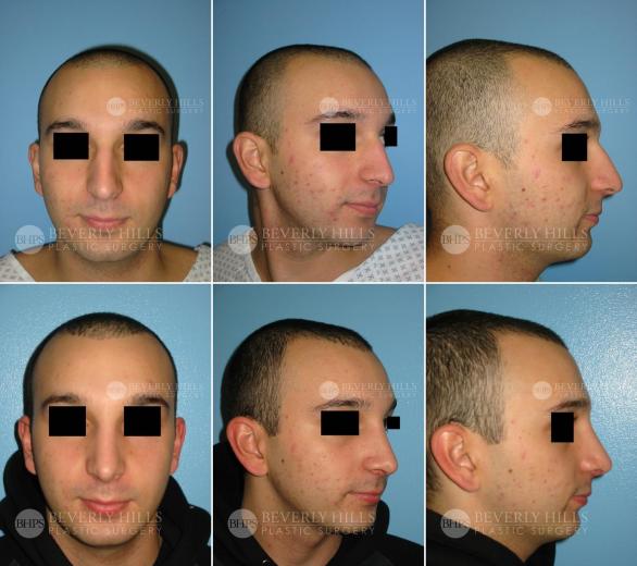 Beverly Hills Plastic Surgery gallery image 383